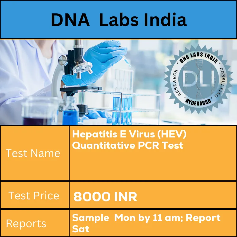 Hepatitis E Virus (HEV) Quantitative PCR Test cost 2 ml (1 ml min.) plasma from 1 Lavender top (EDTA) tube. Separate plasma aseptically within 4 hours of collection. Ship refrigerated or frozen. INR in India