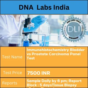 Immunohistochemistry Bladder vs Prostate Carcinoma Panel Test cost Submit tumor tissue in 10% Formal-saline OR Formalin fixed paraffin embedded block. Ship at room temperature. Provide a copy of the Histopathology report