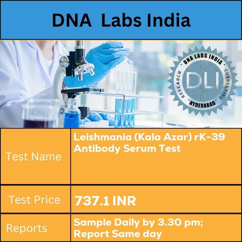 Leishmania (Kala Azar) rK-39 Antibody Serum Test cost 2 mL (1 mL min.) serum from 1 SST. Ship refrigerated. DO NOT FREEZE. INR in India