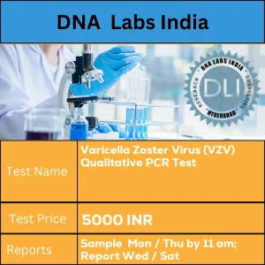 Varicella Zoster Virus (VZV) Qualitative PCR Test cost 3 mL (2 mL min.) whole blood from 1 Lavender Top (EDTA) tube OR 3 mL (2 mL min.) CSF in a sterile screw capped container. Ship refrigerated. DO NOT FREEZE. INR in India