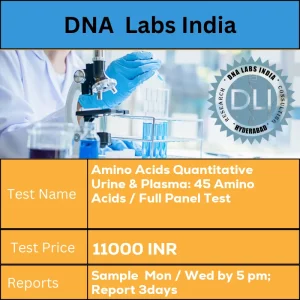 Amino Acids Quantitative Urine & Plasma: 45 Amino Acids / Full Panel Test cost 5 mL (2 mL min.) aliquot of first morning urine in a sterile screw capped container. No preservative required  AND  2 mL (1 mL min.) plasma from 1 Green Top (Sodium Heparin) tube. Transfer plasma into a sterile screw capped vial. Ship refrigerated or frozen. Clinical details and drug history must accompany sample. INR in India