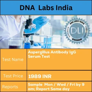 Aspergillus Antibody IgG Serum Test cost 2 mL (1 mL min.) serum from 1 SST. Ship refrigerated or frozen. INR in India