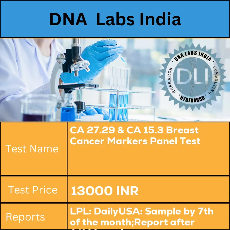 CA 27.29 & CA 15.3 Breast Cancer Markers Panel Test cost 2 mL (1 mL min.) serum from 1 SST. Ship refrigerated or frozen. Provide brief clinical history. INR in India