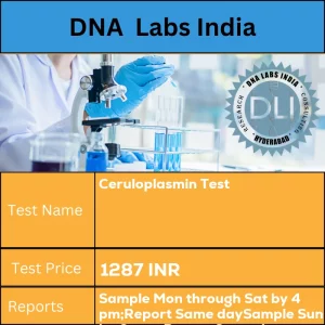 Ceruloplasmin Test cost 2 mL (0.5 mL min.) serum from 1 SST.  Ship refrigerated or frozen. Overnight fasting is preferred. INR in India