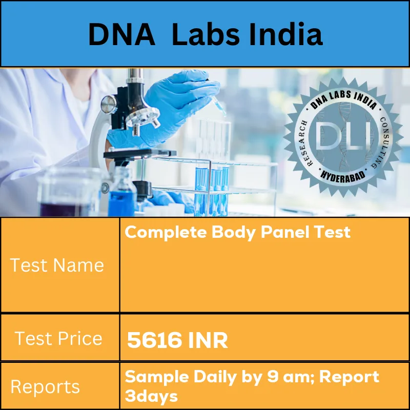 Complete Body Panel Test cost 2 mL (1 mL min.) plasma each from 2 Grey Top (Sodium Fluoride) tubes for Glucose F & PP AND 3 mL (2 mL min.) serum from 1 SST AND 3 mL (2 mL min.) whole blood from 1 Lavender Top (EDTA) tube AND 10 mL (5 mL min.) aliquot of random urine. Ship refrigerated. DO NOT FREEZE. 12 hours overnight fasting is mandatory. INR in India