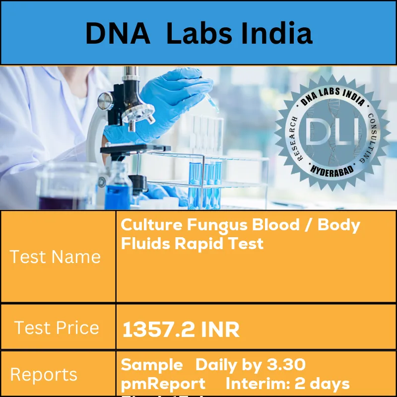 Culture Fungus Blood / Body Fluids Rapid Test cost Collect 8-10 mL whole blood / body fluids aseptically in a Myco / F-Lytic bottle available from LPL. Mix by gentle swirling. Ship at room temperature. INR in India