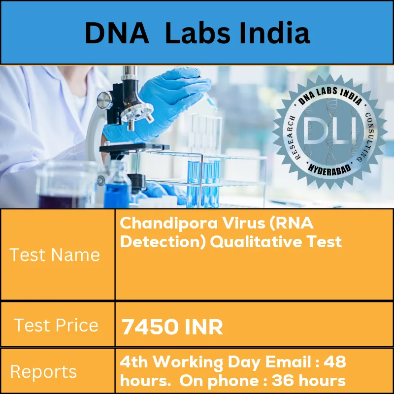 Chandipora Virus (RNA Detection) Qualitative Test cost Whole Blood