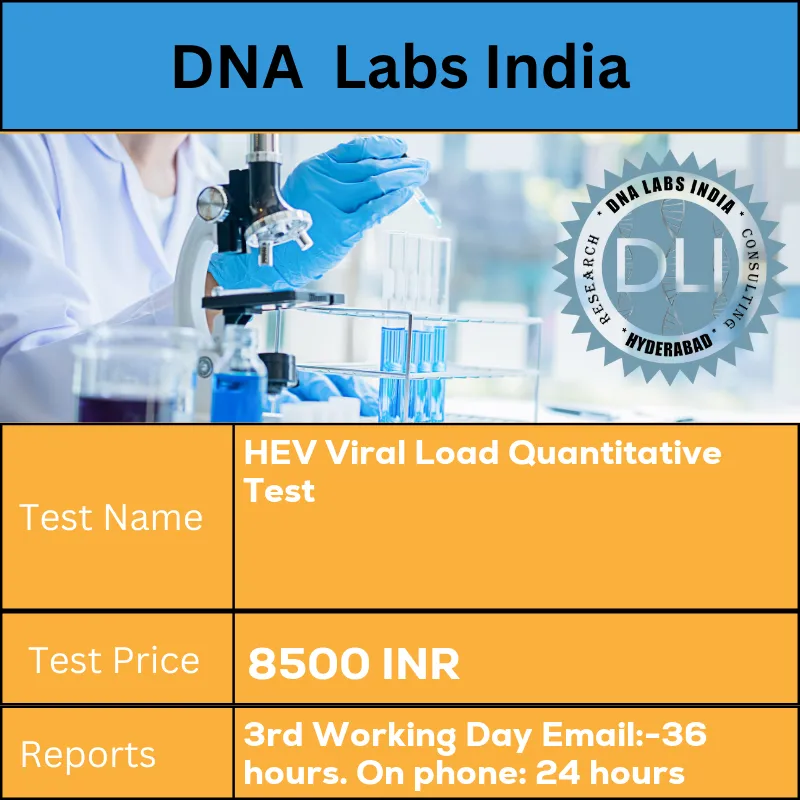 HEV Viral Load Quantitative Test cost Whole Blood