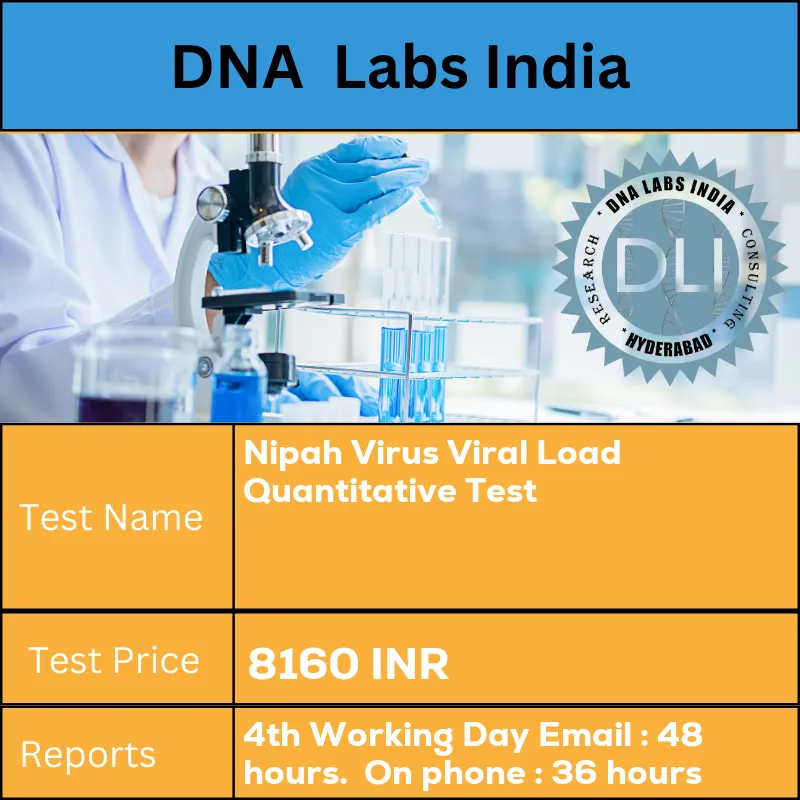 Nipah Virus Viral Load Quantitative Test cost Whole Blood