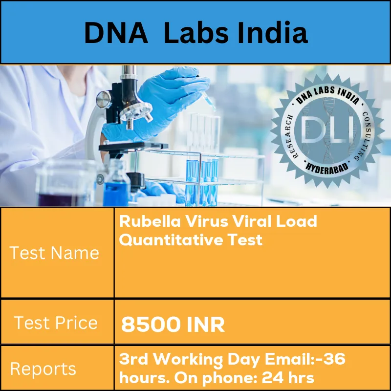 Rubella Virus Viral Load Quantitative Test cost Whole blood
