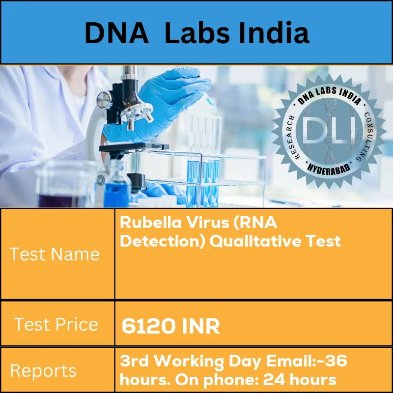 Rubella Virus (RNA Detection) Qualitative Test cost Whole blood