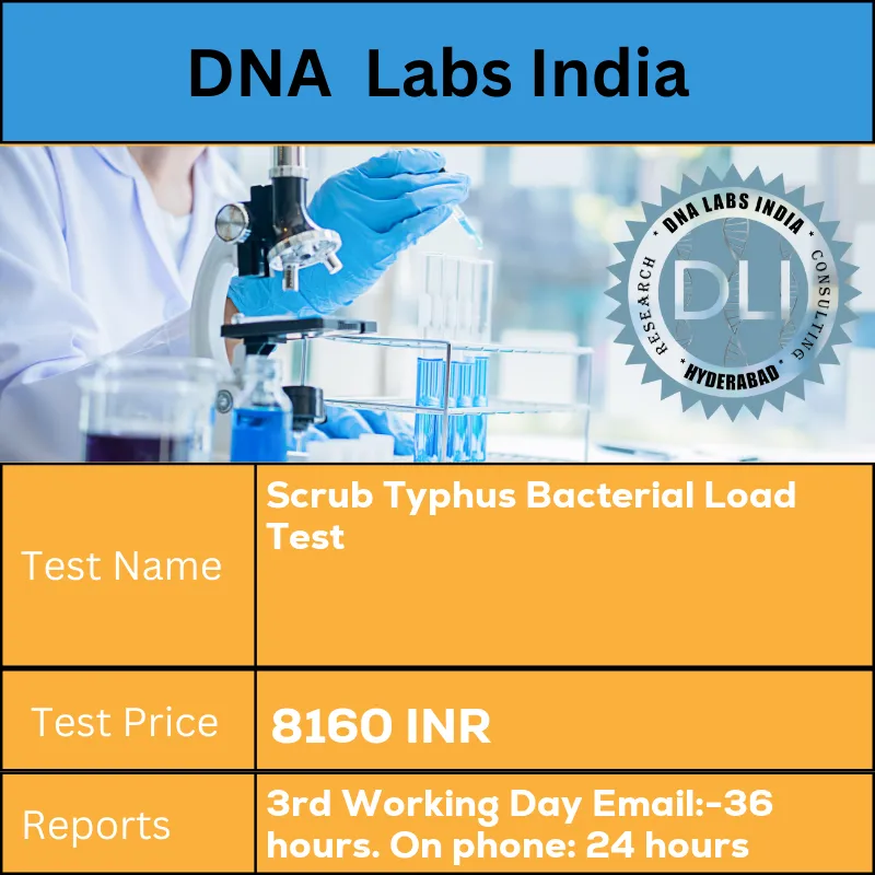 Scrub Typhus Bacterial Load Test cost Serum