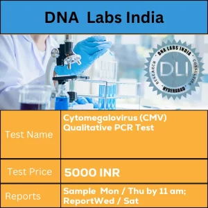 Cytomegalovirus (CMV) Qualitative PCR Test cost 5 mL (3 mL min.) Amniotic fluid in a sterile screw capped container collected after 21 weeks of pregnancy for Prenatal testing OR 10 mL(5 mL min.) Urine/Saliva in a sterile screw capped container OR 2 mL(1 mL min.) Plasma from 1 Lavender top (EDTA) tube OR 2 mL(1 mL min.) Serum from 1 Red top (No additive) tube OR 2 mL(1 mL min.) CSF/BAL fluid in a sterile screw capped container OR 5 g (3 g min.) Fresh Tissue in normal saline.  nShip refrigerated. Separate serum / plasma aseptically within 2 hours of collection. 12 hours overnight fasting is recommended. Nature of specimen on Test Request Form is mandatory. INR in India
