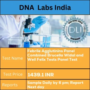 Febrile Agglutinins Panel Combined Brucella Widal and Weil Felix Tests Panel Test cost 3 mL (2 mL min.) serum from 1 SST. Ship refrigerated or frozen. INR in India