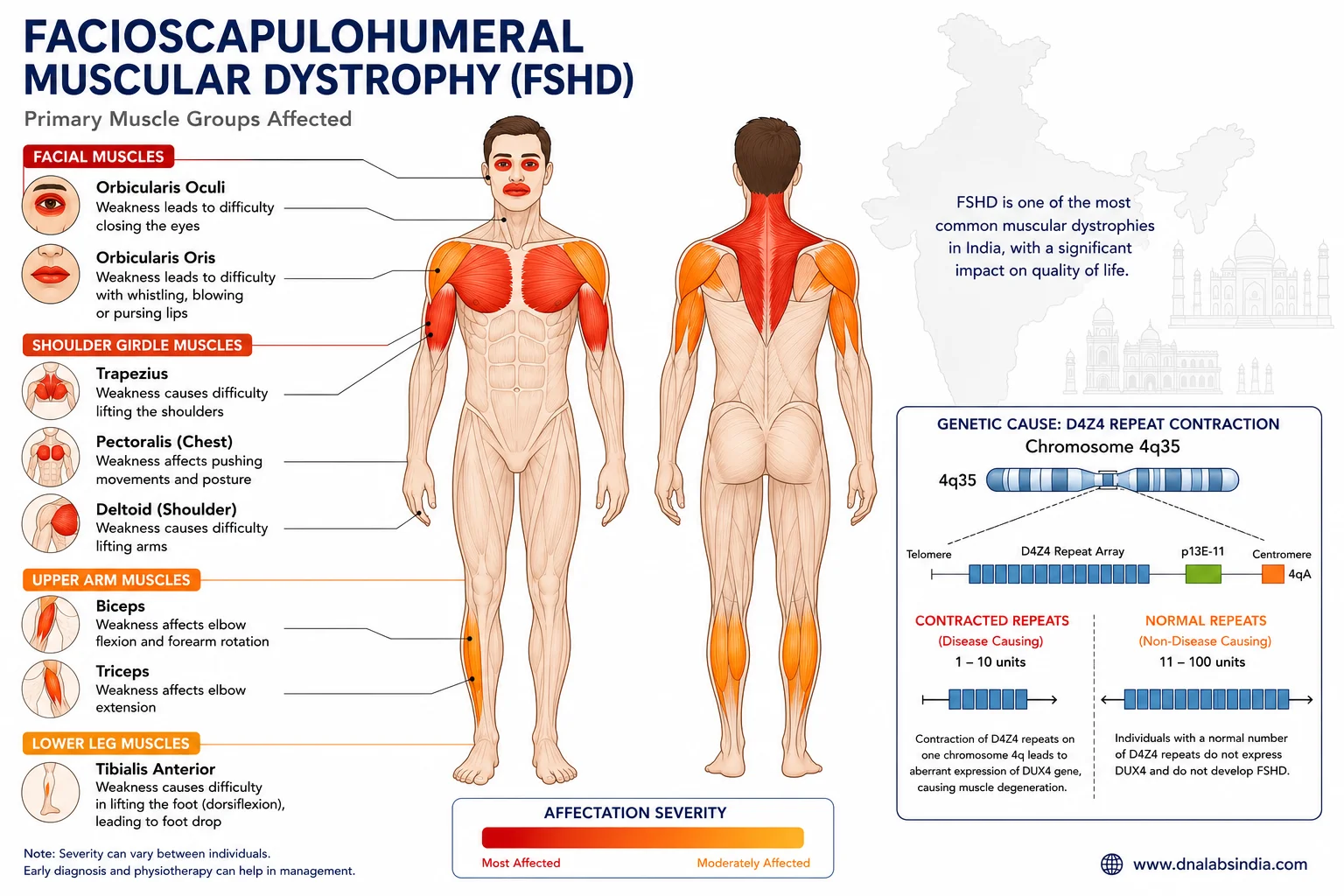 Understanding Facioscapulohumeral Muscular Dystrophy (FSHD) - affected muscle groups and genetic illustration